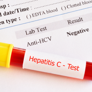 what type of doctor treats hep c